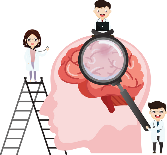 Hemorrhagic brain stroke concept. Apoplexy, cerebral hemorrh